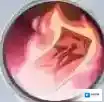 永夜降临复苏治疗效果